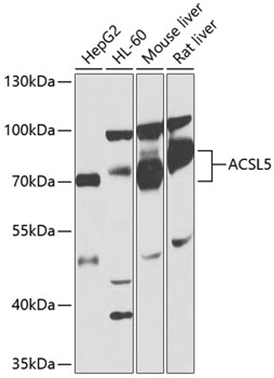 Western blot analysis of extracts of various cell lines, using ACSL5 antibody (14-586) at 1:1000 dilution.<br/>Secondary antibody: HRP Goat Anti-Rabbit IgG (H+L) at 1:10000 dilution.<br/>Lysates/proteins: 25ug per lane.<br/>Blocking buffer: 3% nonfat dry milk in TBST.<br/>Detection: ECL Basic Kit.<br/>Exposure time: 1s.