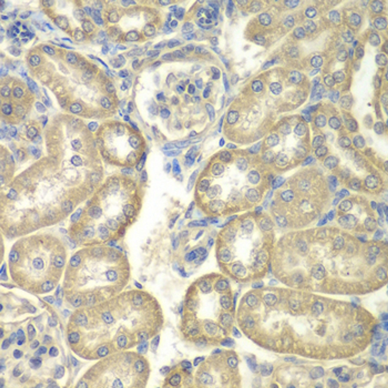 Immunohistochemistry of paraffin-embedded rat kidney using ACSL5 antibody (14-586) at dilution of 1:100 (40x lens) .