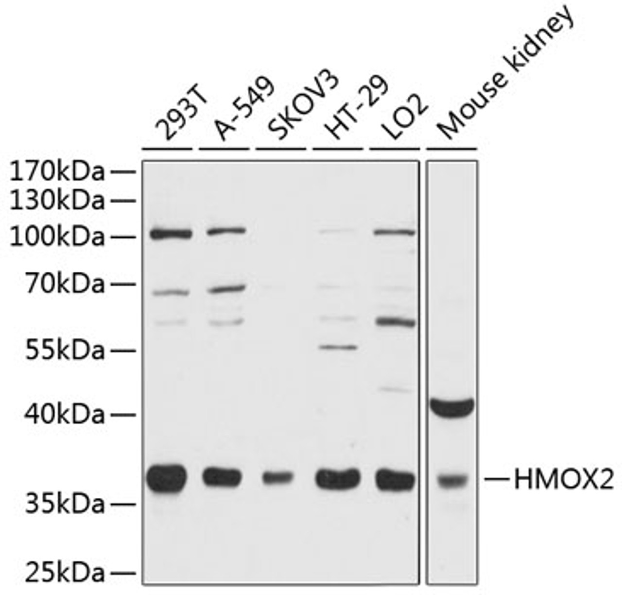 Western blot analysis of extracts of various cell lines, using HMOX2 antibody (14-591) at 1:3000 dilution.<br/>Secondary antibody: HRP Goat Anti-Rabbit IgG (H+L) at 1:10000 dilution.<br/>Lysates/proteins: 25ug per lane.<br/>Blocking buffer: 3% nonfat dry milk in TBST.<br/>Detection: ECL Basic Kit.<br/>Exposure time: 10s.