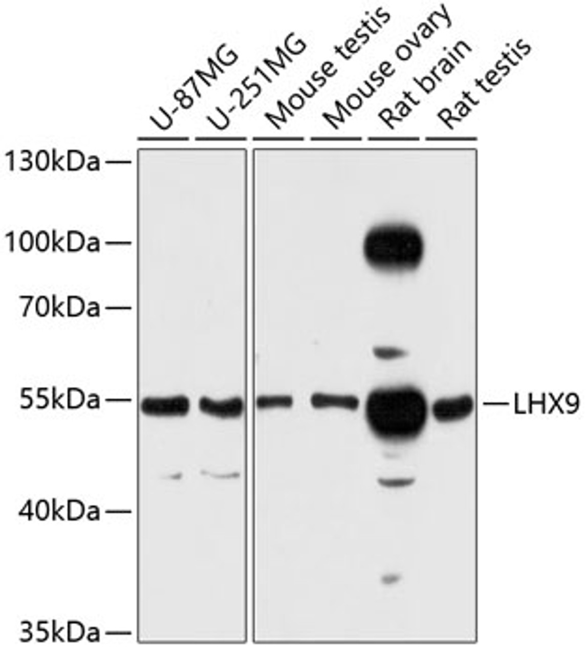 Western blot analysis of extracts of various cell lines, using LHX9 antibody (14-594) at 1:3000 dilution.<br/>Secondary antibody: HRP Goat Anti-Rabbit IgG (H+L) at 1:10000 dilution.<br/>Lysates/proteins: 25ug per lane.<br/>Blocking buffer: 3% nonfat dry milk in TBST.<br/>Detection: ECL Enhanced Kit.<br/>Exposure time: 90s.