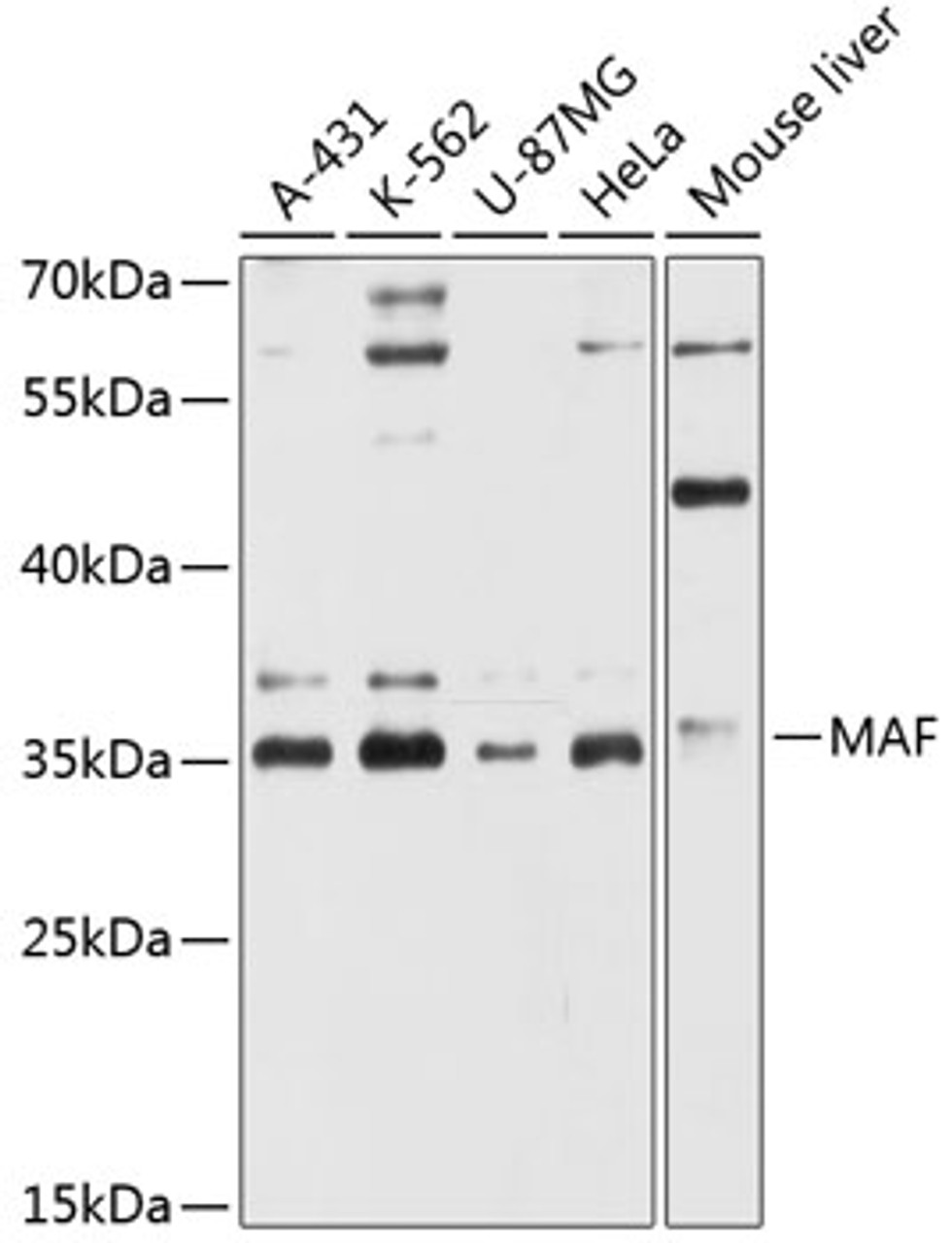 Western blot analysis of extracts of various cell lines, using MAF antibody (14-598) at 1:3000 dilution.<br/>Secondary antibody: HRP Goat Anti-Rabbit IgG (H+L) at 1:10000 dilution.<br/>Lysates/proteins: 25ug per lane.<br/>Blocking buffer: 3% nonfat dry milk in TBST.<br/>Detection: ECL Basic Kit.<br/>Exposure time: 30s.