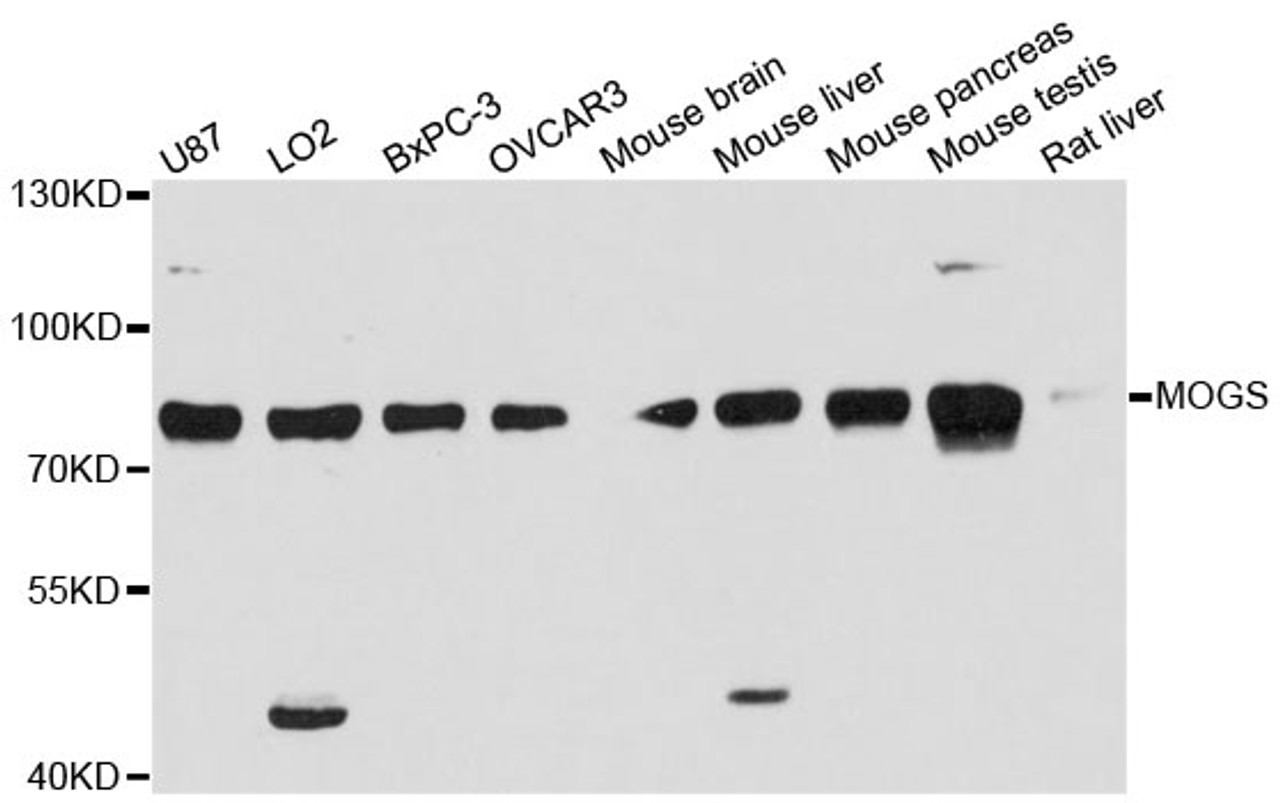 Western blot analysis of extracts of various cell lines, using MOGS antibody (14-601) at 1:3000 dilution.<br/>Secondary antibody: HRP Goat Anti-Rabbit IgG (H+L) at 1:10000 dilution.<br/>Lysates/proteins: 25ug per lane.<br/>Blocking buffer: 3% nonfat dry milk in TBST.<br/>Detection: ECL Basic Kit.<br/>Exposure time: 90s.