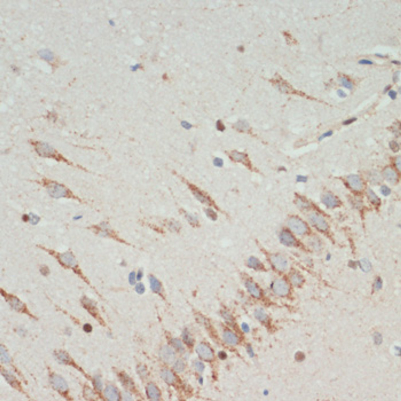 Immunohistochemistry of paraffin-embedded rat brain using TH antibody (14-615) at dilution of 1:200 (40x lens) .