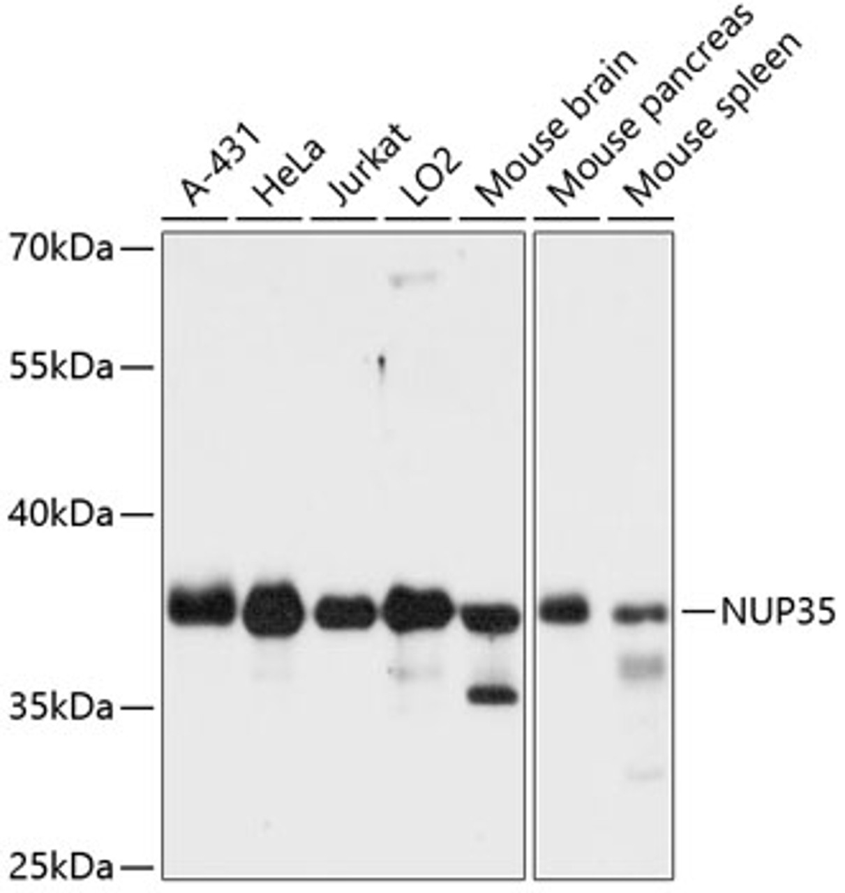 Western blot analysis of extracts of various cell lines, using NUP35 antibody (14-617) at 1:3000 dilution.<br/>Secondary antibody: HRP Goat Anti-Rabbit IgG (H+L) at 1:10000 dilution.<br/>Lysates/proteins: 25ug per lane.<br/>Blocking buffer: 3% nonfat dry milk in TBST.<br/>Detection: ECL Basic Kit.<br/>Exposure time: 5s.
