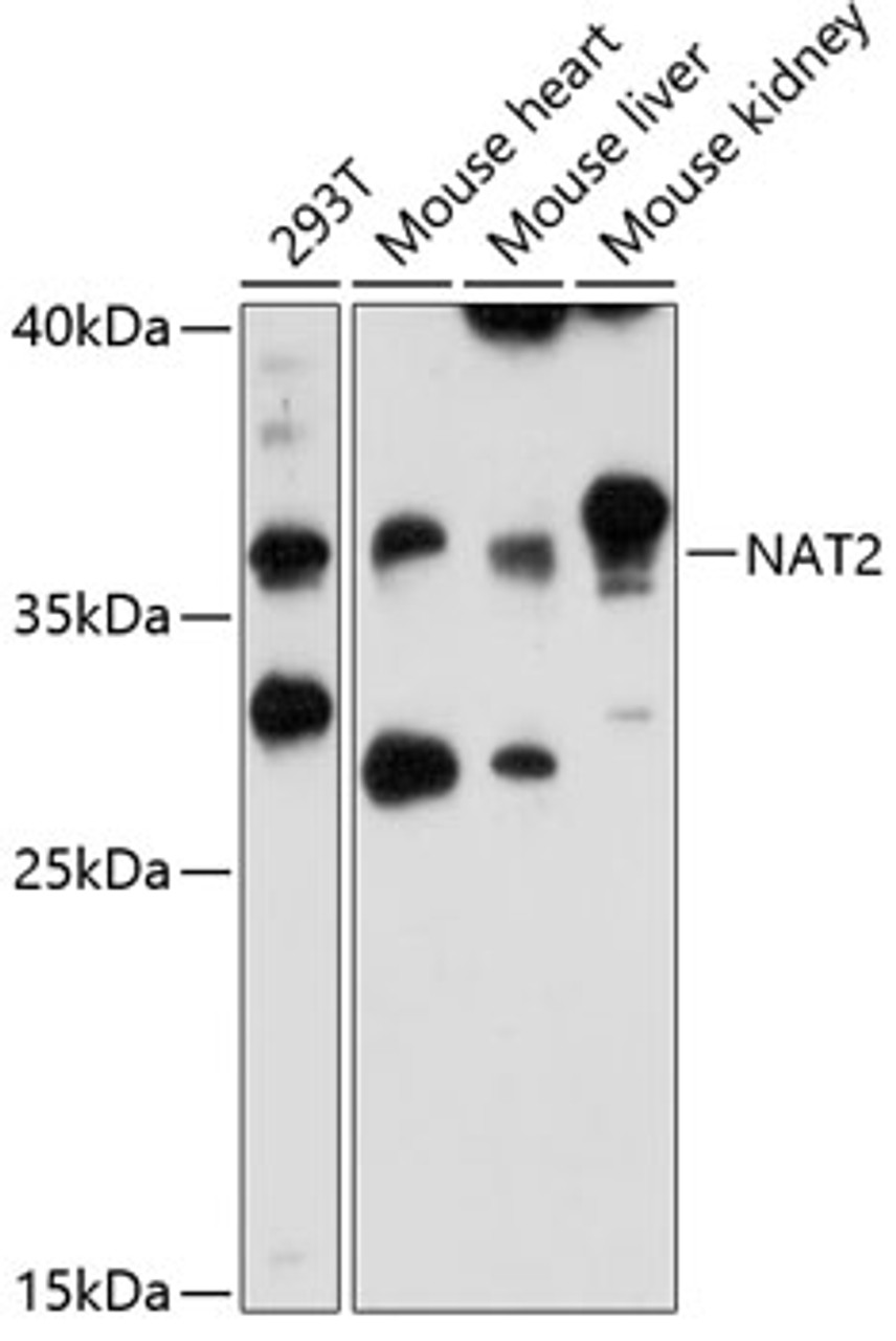 Western blot analysis of extracts of various cell lines, using NAT2 antibody (14-619) at 1:3000 dilution.<br/>Secondary antibody: HRP Goat Anti-Rabbit IgG (H+L) at 1:10000 dilution.<br/>Lysates/proteins: 25ug per lane.<br/>Blocking buffer: 3% nonfat dry milk in TBST.<br/>Detection: ECL Enhanced Kit.<br/>Exposure time: 30s.