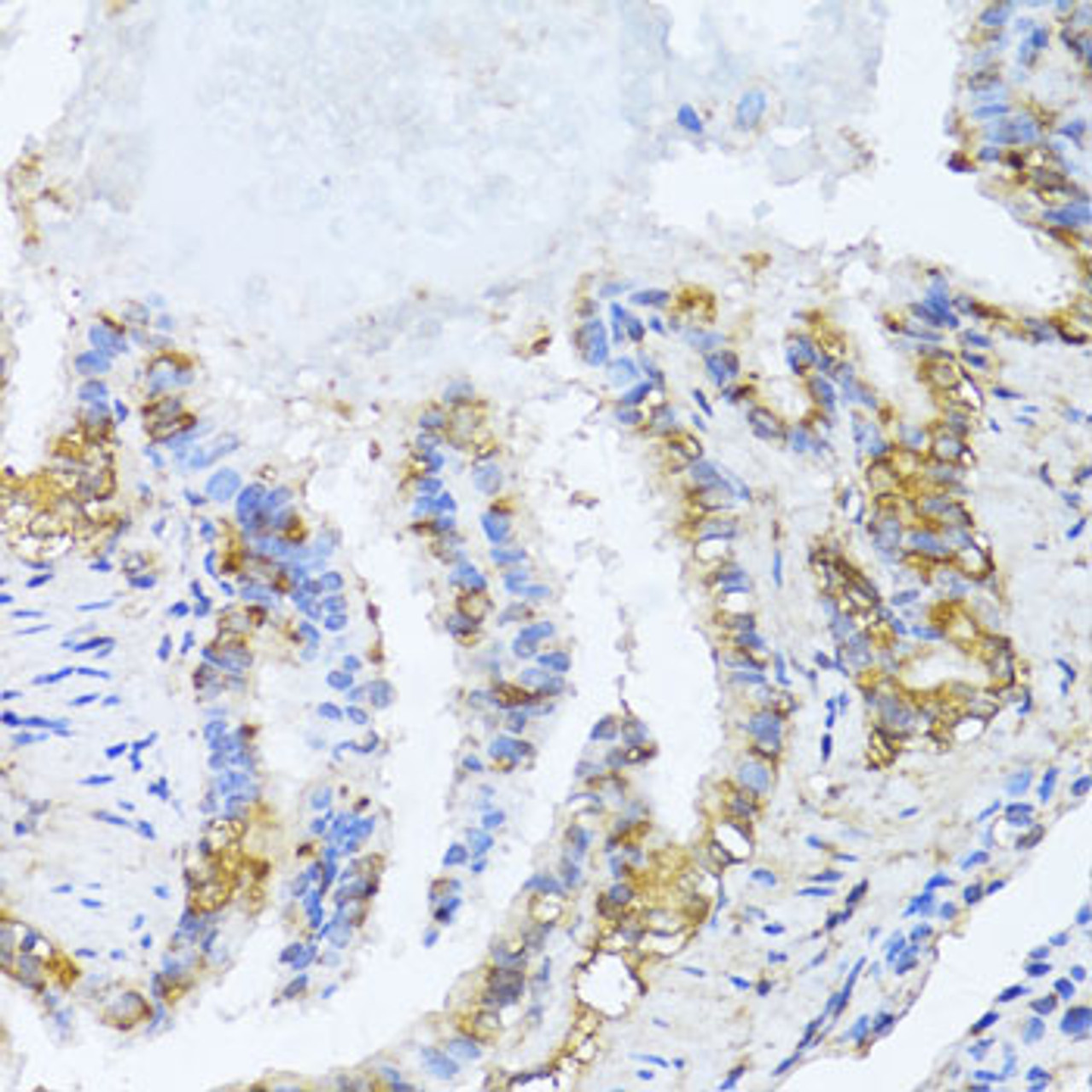 Immunohistochemistry of paraffin-embedded rat lung using NAT2 antibody (14-619) at dilution of 1:100 (40x lens) .