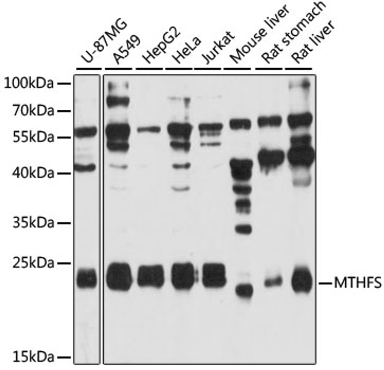 Western blot analysis of extracts of various cell lines, using MTHFS antibody (14-620) at 1:3000 dilution.<br/>Secondary antibody: HRP Goat Anti-Rabbit IgG (H+L) at 1:10000 dilution.<br/>Lysates/proteins: 25ug per lane.<br/>Blocking buffer: 3% nonfat dry milk in TBST.<br/>Detection: ECL Basic Kit.<br/>Exposure time: 90s.