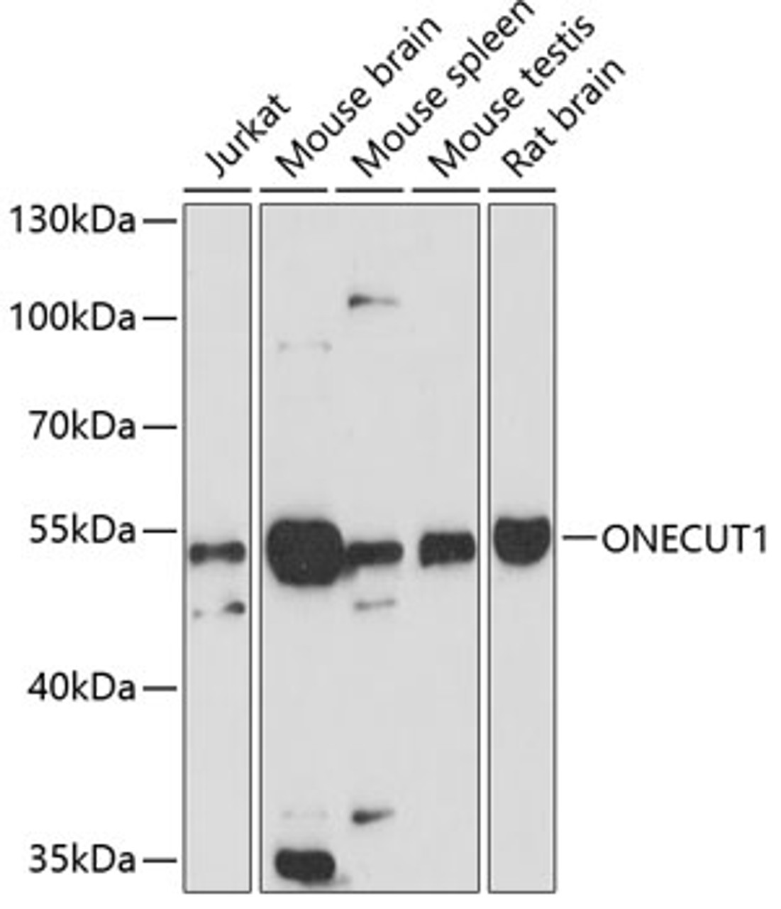 Western blot analysis of extracts of various cell lines, using ONECUT1 antibody (14-622) at 1:3000 dilution.<br/>Secondary antibody: HRP Goat Anti-Rabbit IgG (H+L) at 1:10000 dilution.<br/>Lysates/proteins: 25ug per lane.<br/>Blocking buffer: 3% nonfat dry milk in TBST.<br/>Detection: ECL Basic Kit.<br/>Exposure time: 90s.