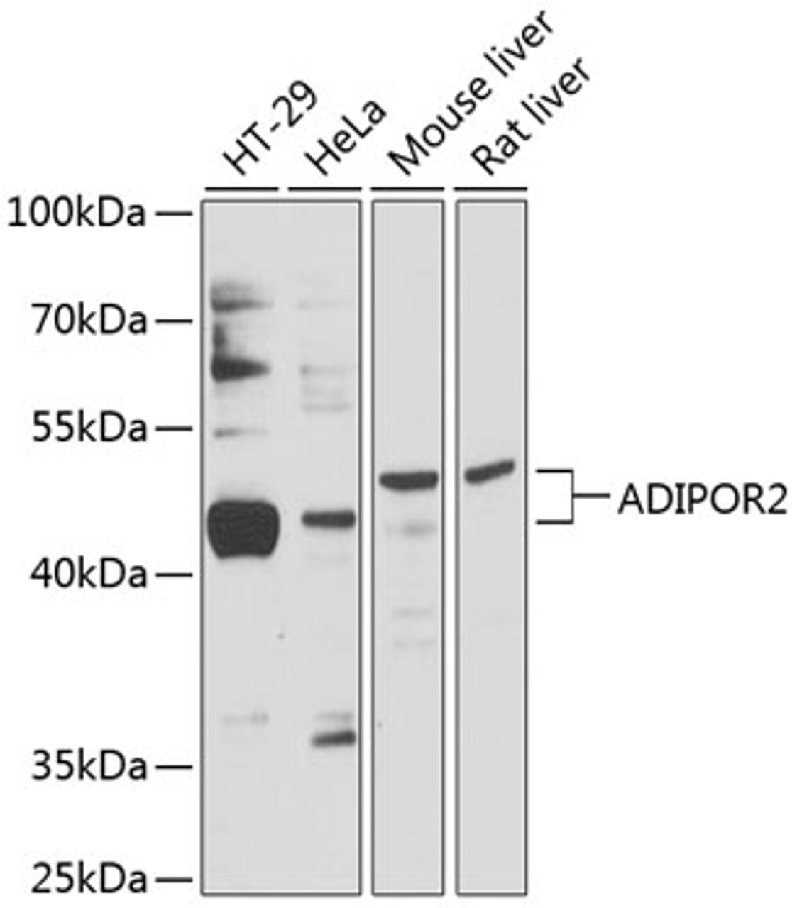 Western blot analysis of extracts of various cell lines, using ADIPOR2 antibody (14-623) at 1:3000 dilution.<br/>Secondary antibody: HRP Goat Anti-Rabbit IgG (H+L) at 1:10000 dilution.<br/>Lysates/proteins: 25ug per lane.<br/>Blocking buffer: 3% nonfat dry milk in TBST.<br/>Detection: ECL Basic Kit.<br/>Exposure time: 10s.