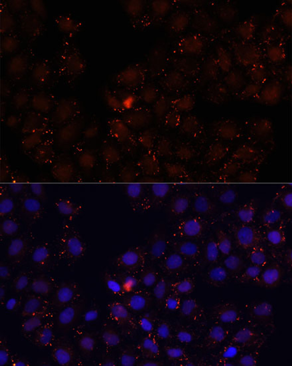 Immunofluorescence analysis of HeLa cells using WDR81 antibody (14-624) at dilution of 1:100. Blue: DAPI for nuclear staining.
