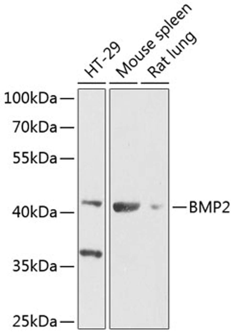 Western blot analysis of extracts of various cell lines, using BMP2 Antibody (14-625) at 1:1000 dilution._Secondary antibody: HRP Goat Anti-Rabbit IgG (H+L) at 1:10000 dilution._Lysates/proteins: 25ug per lane._Blocking buffer: 3% nonfat dry milk in TBST._Detection: ECL Enhanced Kit._Exposure time: 30s.