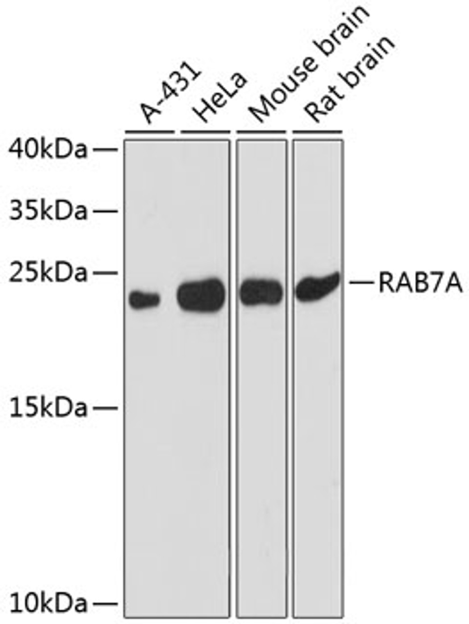 Western blot analysis of extracts of various cell lines, using RAB7A antibody (14-627) at 1:3000 dilution._Secondary antibody: HRP Goat Anti-Rabbit IgG (H+L) at 1:10000 dilution._Lysates/proteins: 25ug per lane._Blocking buffer: 3% nonfat dry milk in TBST._Detection: ECL Enhanced Kit._Exposure time: 90s.