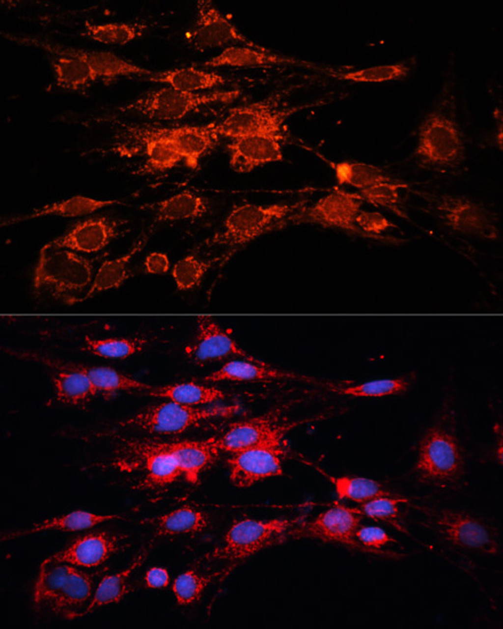 Immunofluorescence analysis of C6 cells using RAB7A antibody (14-627) at dilution of 1:100. Blue: DAPI for nuclear staining.