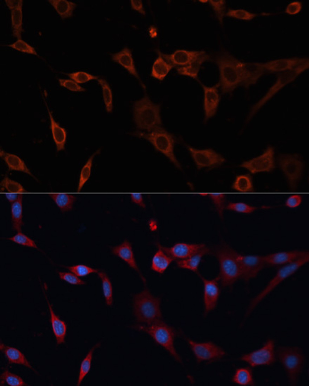 Immunofluorescence analysis of NIH/3T3 cells using PDIA2 antibody (14-628) at dilution of 1:100. Blue: DAPI for nuclear staining.