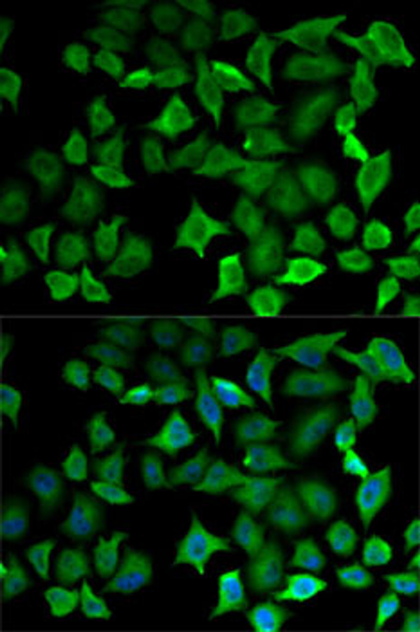 Immunofluorescence analysis of HeLa cells using NOS1 antibody (14-632) . Blue: DAPI for nuclear staining.