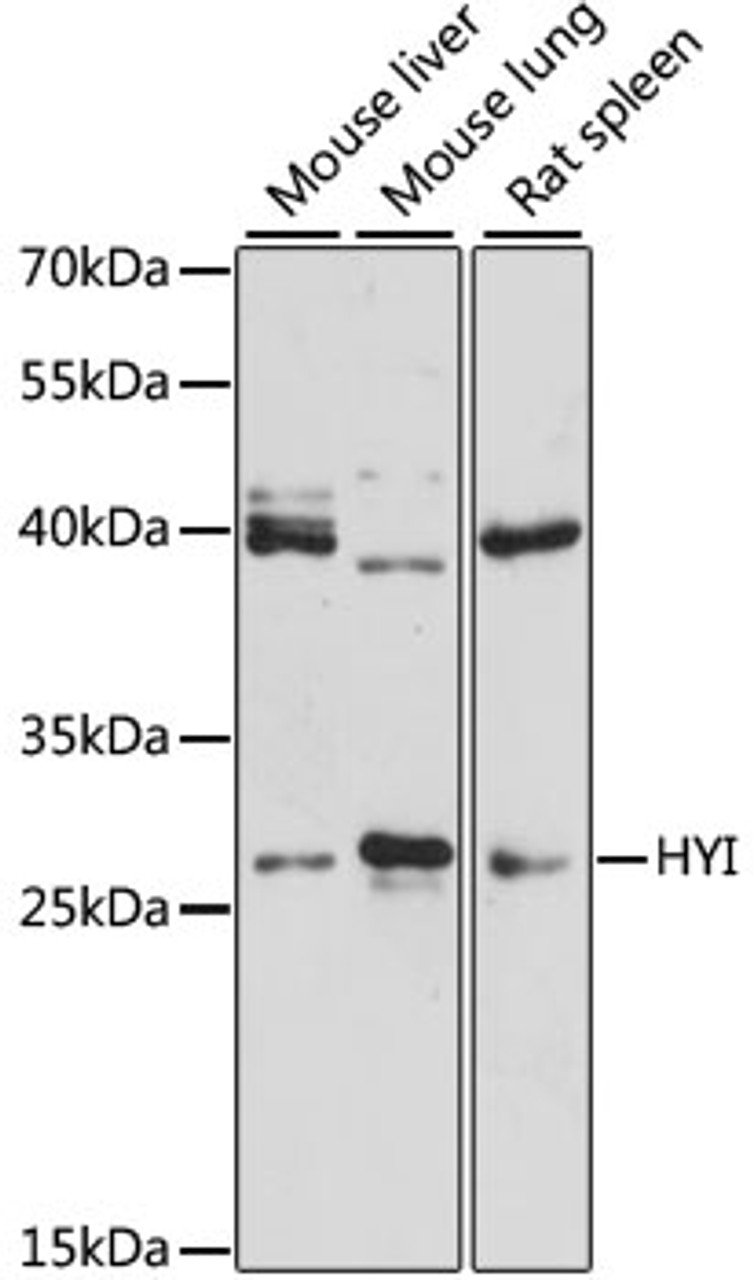 Western blot analysis of extracts of various cell lines, using HYI antibody (14-636) at 1:3000 dilution.<br/>Secondary antibody: HRP Goat Anti-Rabbit IgG (H+L) at 1:10000 dilution.<br/>Lysates/proteins: 25ug per lane.<br/>Blocking buffer: 3% nonfat dry milk in TBST.<br/>Detection: ECL Enhanced Kit.<br/>Exposure time: 90s.