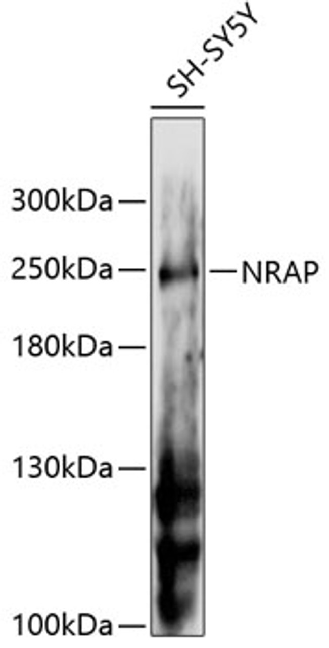 Western blot analysis of extracts of SH-SY5Y cells, using NRAP antibody (14-641) at 1:3000 dilution.<br/>Secondary antibody: HRP Goat Anti-Rabbit IgG (H+L) at 1:10000 dilution.<br/>Lysates/proteins: 25ug per lane.<br/>Blocking buffer: 3% nonfat dry milk in TBST.<br/>Detection: ECL Enhanced Kit.<br/>Exposure time: 30s.