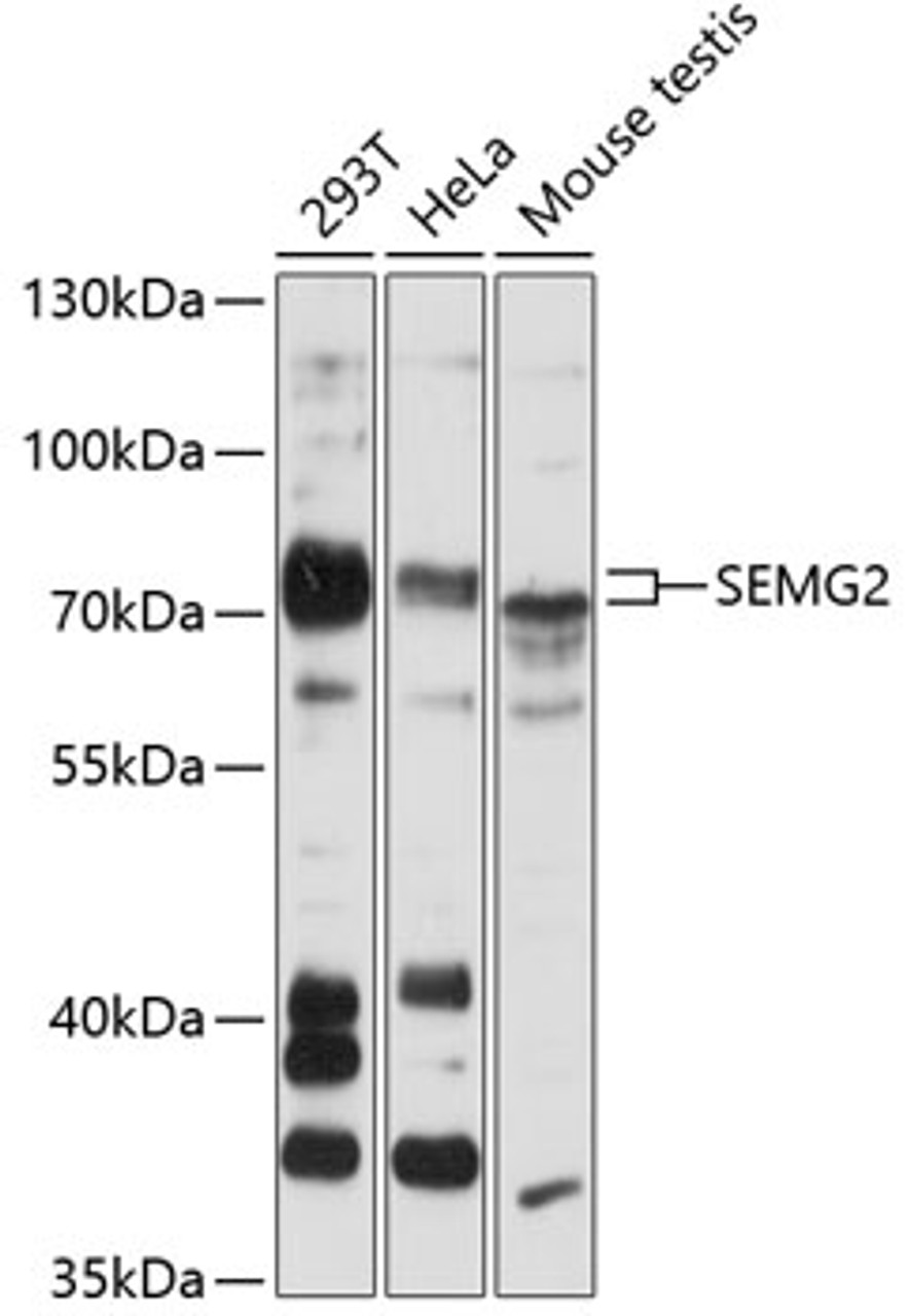 Western blot analysis of extracts of various cell lines, using SEMG2 antibody (14-648) at 1:3000 dilution.<br/>Secondary antibody: HRP Goat Anti-Rabbit IgG (H+L) at 1:10000 dilution.<br/>Lysates/proteins: 25ug per lane.<br/>Blocking buffer: 3% nonfat dry milk in TBST.<br/>Detection: ECL Basic Kit.<br/>Exposure time: 30s.