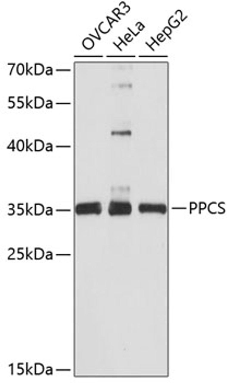 Western blot analysis of extracts of various cell lines, using PPCS antibody (14-649) at 1:3000 dilution.<br/>Secondary antibody: HRP Goat Anti-Rabbit IgG (H+L) at 1:10000 dilution.<br/>Lysates/proteins: 25ug per lane.<br/>Blocking buffer: 3% nonfat dry milk in TBST.<br/>Detection: ECL Basic Kit.<br/>Exposure time: 90s.
