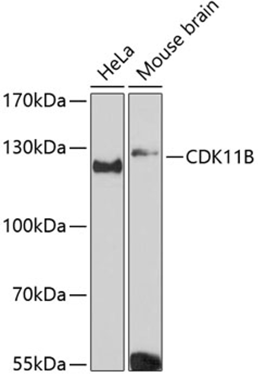 Western blot analysis of extracts of various cell lines, using CDK11B Antibody (14-650) at 1:3000 dilution.<br/>Secondary antibody: HRP Goat Anti-Rabbit IgG (H+L) at 1:10000 dilution.<br/>Lysates/proteins: 25ug per lane.<br/>Blocking buffer: 3% nonfat dry milk in TBST.<br/>Detection: ECL Basic Kit.<br/>Exposure time: 90s.