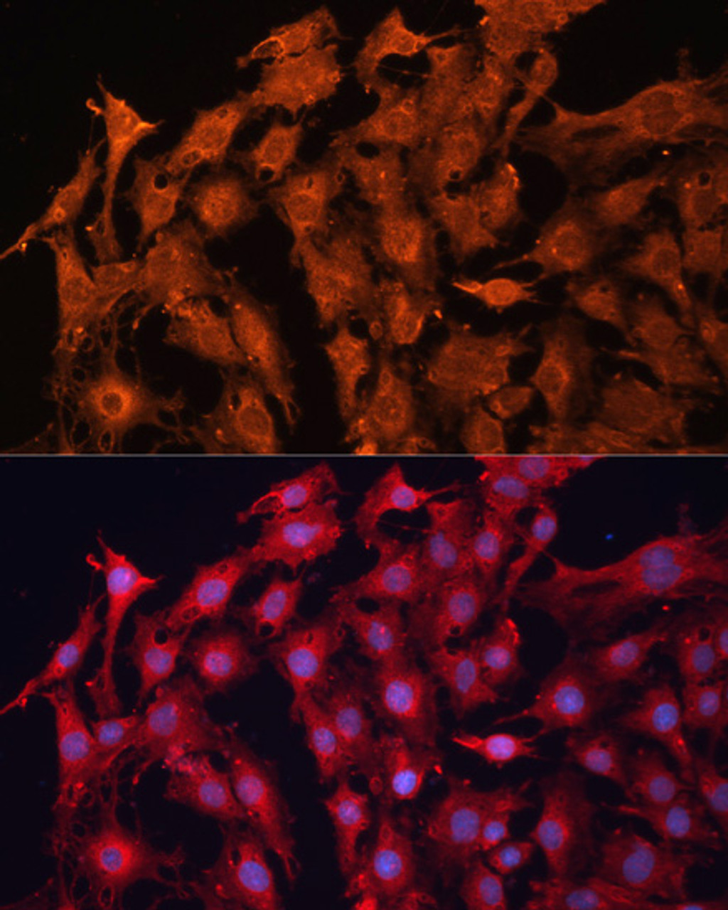 Immunofluorescence analysis of C6 cells using P Glycoprotein antibody (14-654) at dilution of 1:100. Blue: DAPI for nuclear staining.