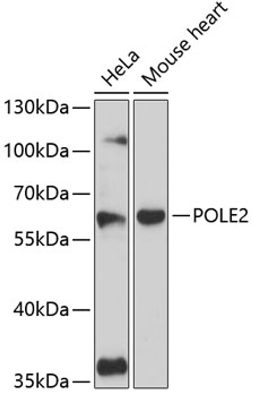 Western blot analysis of extracts of various cell lines, using POLE2 antibody (14-655) at 1:3000 dilution.<br/>Secondary antibody: HRP Goat Anti-Rabbit IgG (H+L) at 1:10000 dilution.<br/>Lysates/proteins: 25ug per lane.<br/>Blocking buffer: 3% nonfat dry milk in TBST.<br/>Detection: ECL Basic Kit.<br/>Exposure time: 90s.