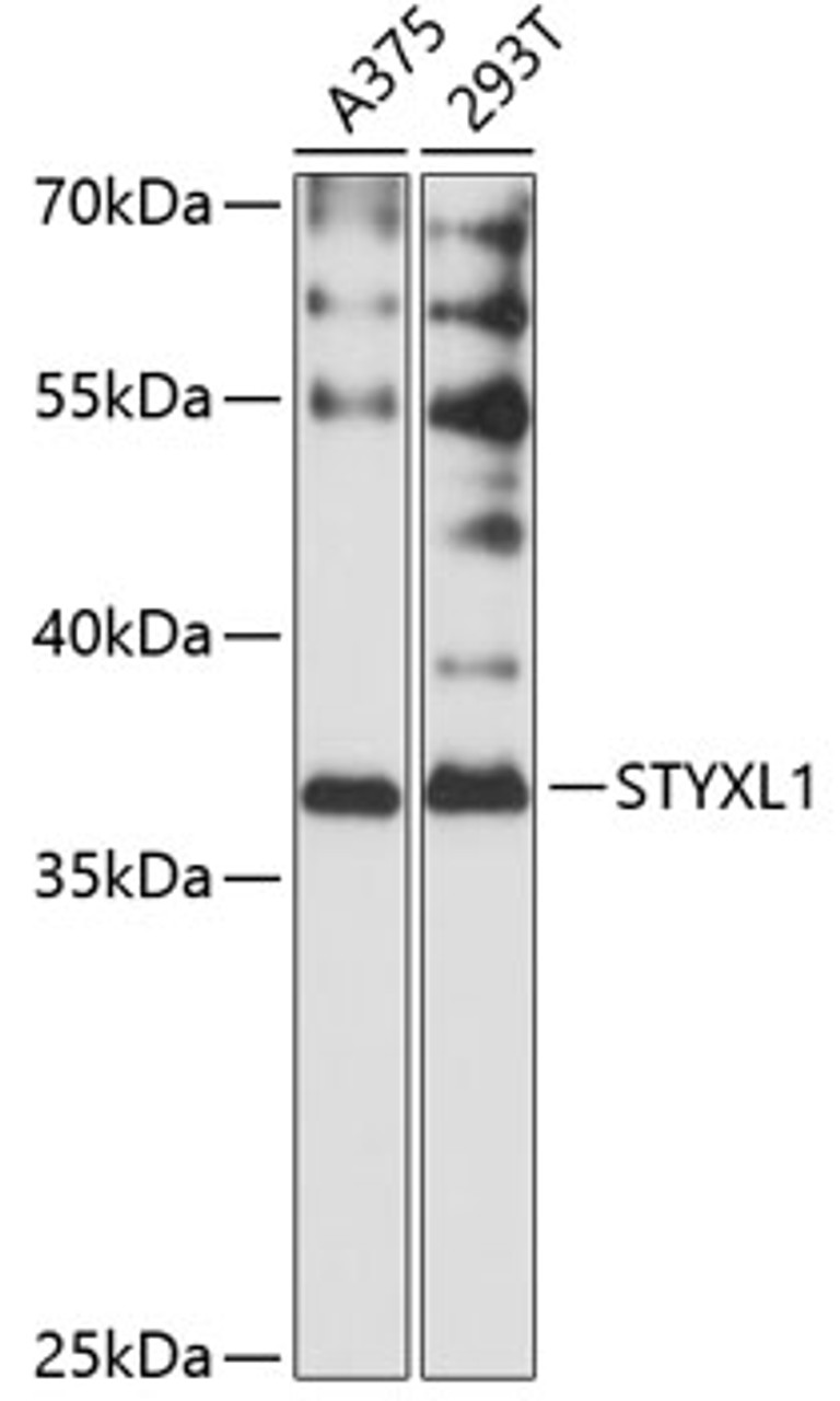 Western blot analysis of extracts of various cell lines, using STYXL1 antibody (14-662) at 1:3000 dilution.<br/>Secondary antibody: HRP Goat Anti-Rabbit IgG (H+L) at 1:10000 dilution.<br/>Lysates/proteins: 25ug per lane.<br/>Blocking buffer: 3% nonfat dry milk in TBST.<br/>Detection: ECL Basic Kit.<br/>Exposure time: 60s.