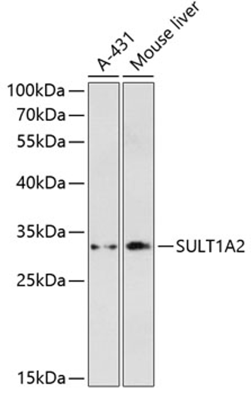 Western blot analysis of extracts of various cell lines, using SULT1A2 antibody (14-663) at 1:3000 dilution.<br/>Secondary antibody: HRP Goat Anti-Rabbit IgG (H+L) at 1:10000 dilution.<br/>Lysates/proteins: 25ug per lane.<br/>Blocking buffer: 3% nonfat dry milk in TBST.<br/>Detection: ECL Enhanced Kit.<br/>Exposure time: 3min.