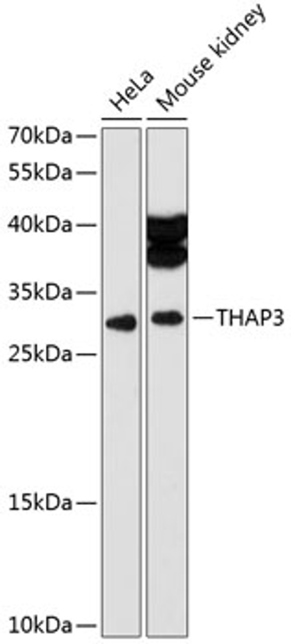 Western blot analysis of extracts of various cell lines, using THAP3 antibody (14-665) at 1:3000 dilution.<br/>Secondary antibody: HRP Goat Anti-Rabbit IgG (H+L) at 1:10000 dilution.<br/>Lysates/proteins: 25ug per lane.<br/>Blocking buffer: 3% nonfat dry milk in TBST.<br/>Detection: ECL Enhanced Kit.<br/>Exposure time: 90s.