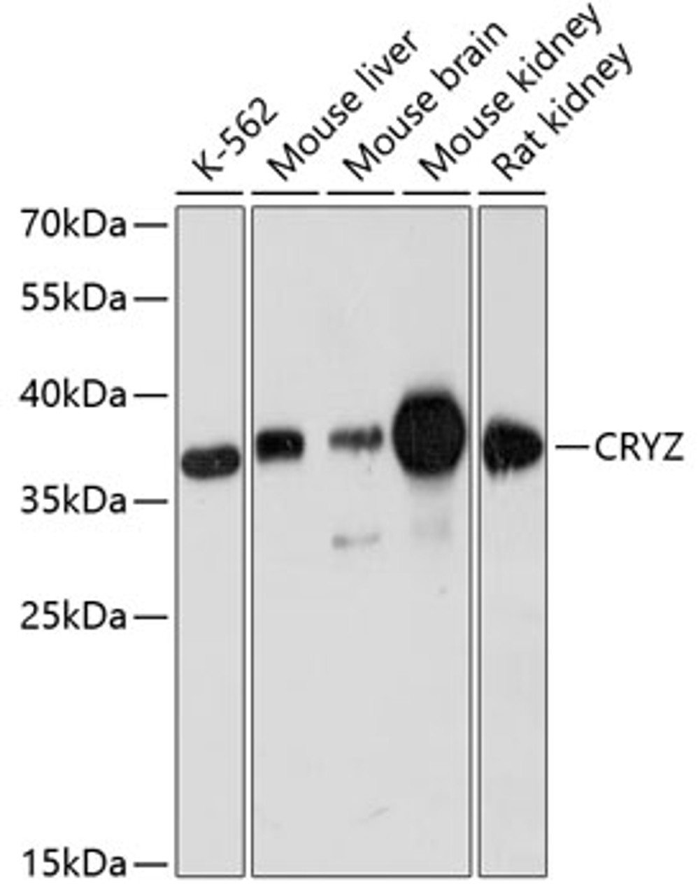 Western blot analysis of extracts of various cell lines, using CRYZ antibody (14-667) at 1:3000 dilution.<br/>Secondary antibody: HRP Goat Anti-Rabbit IgG (H+L) at 1:10000 dilution.<br/>Lysates/proteins: 25ug per lane.<br/>Blocking buffer: 3% nonfat dry milk in TBST.<br/>Detection: ECL Basic Kit.<br/>Exposure time: 30s.