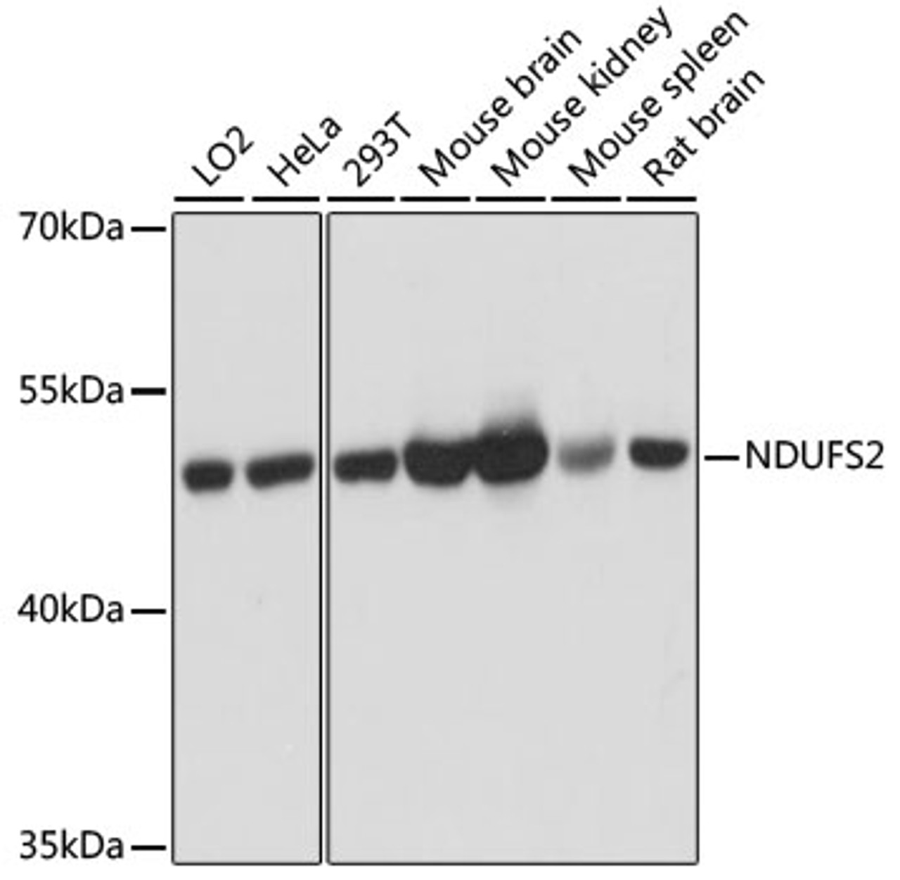 Western blot analysis of extracts of various cell lines, using NDUFS2 antibody (14-668) at 1:3000 dilution.<br/>Secondary antibody: HRP Goat Anti-Rabbit IgG (H+L) at 1:10000 dilution.<br/>Lysates/proteins: 25ug per lane.<br/>Blocking buffer: 3% nonfat dry milk in TBST.<br/>Detection: ECL Basic Kit.<br/>Exposure time: 1s.