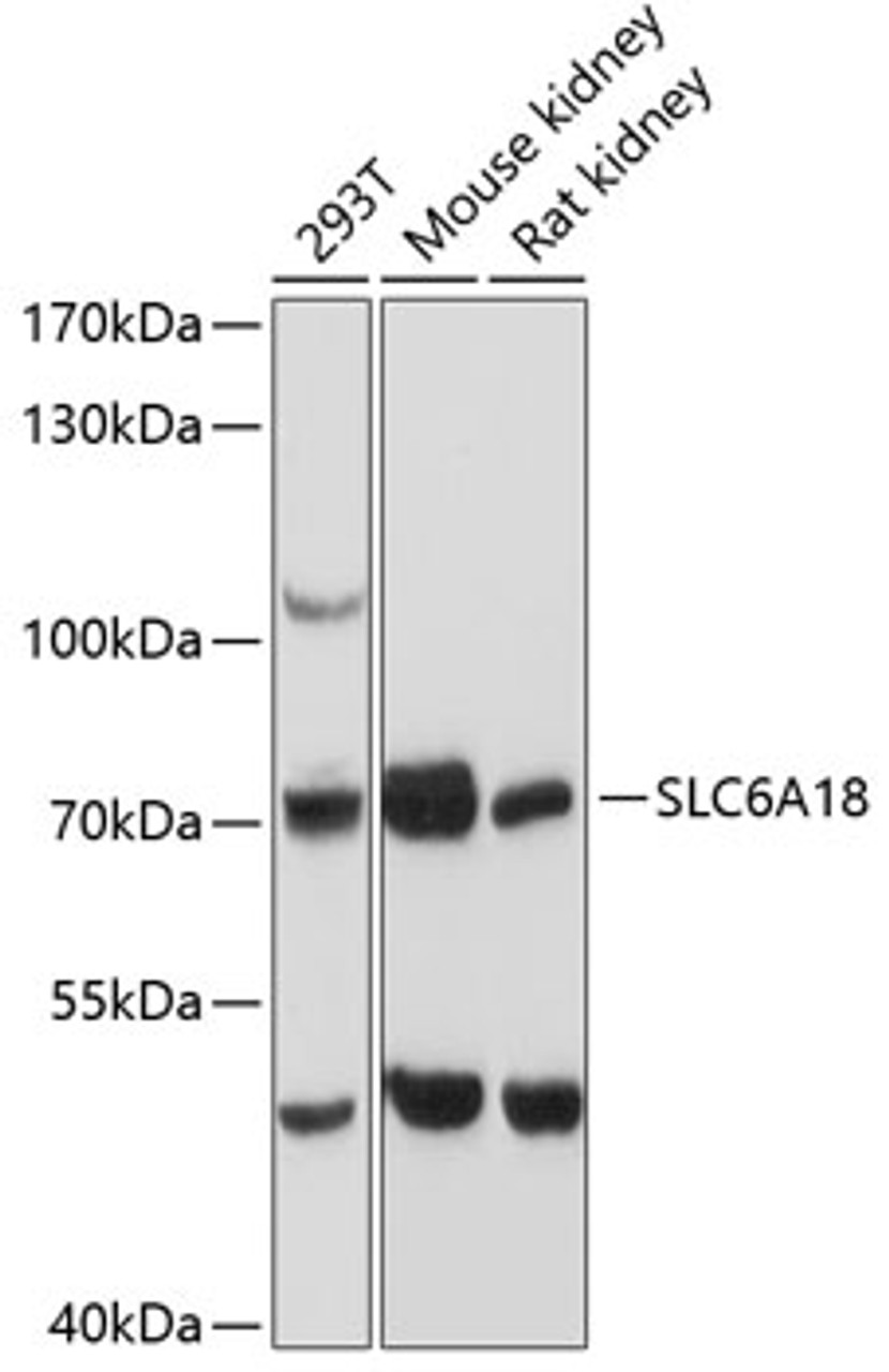 Western blot analysis of extracts of various cell lines, using SLC6A18 antibody (14-669) at 1:3000 dilution.<br/>Secondary antibody: HRP Goat Anti-Rabbit IgG (H+L) at 1:10000 dilution.<br/>Lysates/proteins: 25ug per lane.<br/>Blocking buffer: 3% nonfat dry milk in TBST.<br/>Detection: ECL Basic Kit.<br/>Exposure time: 30s.