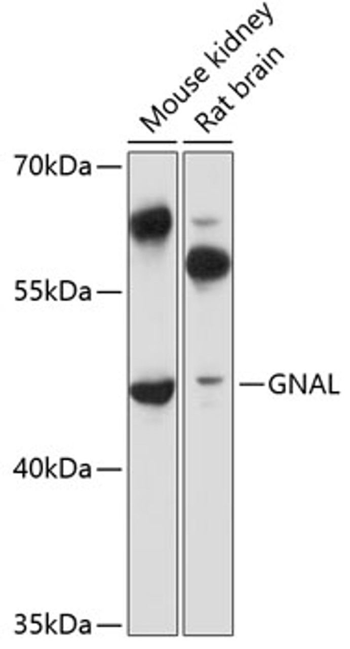 Western blot analysis of extracts of various cell lines, using GNAL antibody (14-675) at 1:3000 dilution.<br/>Secondary antibody: HRP Goat Anti-Rabbit IgG (H+L) at 1:10000 dilution.<br/>Lysates/proteins: 25ug per lane.<br/>Blocking buffer: 3% nonfat dry milk in TBST.<br/>Detection: ECL Basic Kit.<br/>Exposure time: 10s.