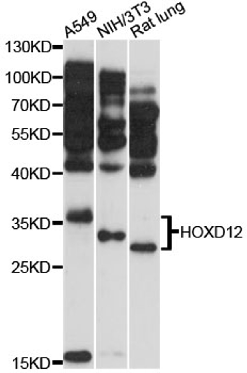 Western blot analysis of extracts of various cell lines, using HOXD12 antibody (14-677) at 1:3000 dilution.<br/>Secondary antibody: HRP Goat Anti-Rabbit IgG (H+L) at 1:10000 dilution.<br/>Lysates/proteins: 25ug per lane.<br/>Blocking buffer: 3% nonfat dry milk in TBST.<br/>Detection: ECL Basic Kit.<br/>Exposure time: 60s.