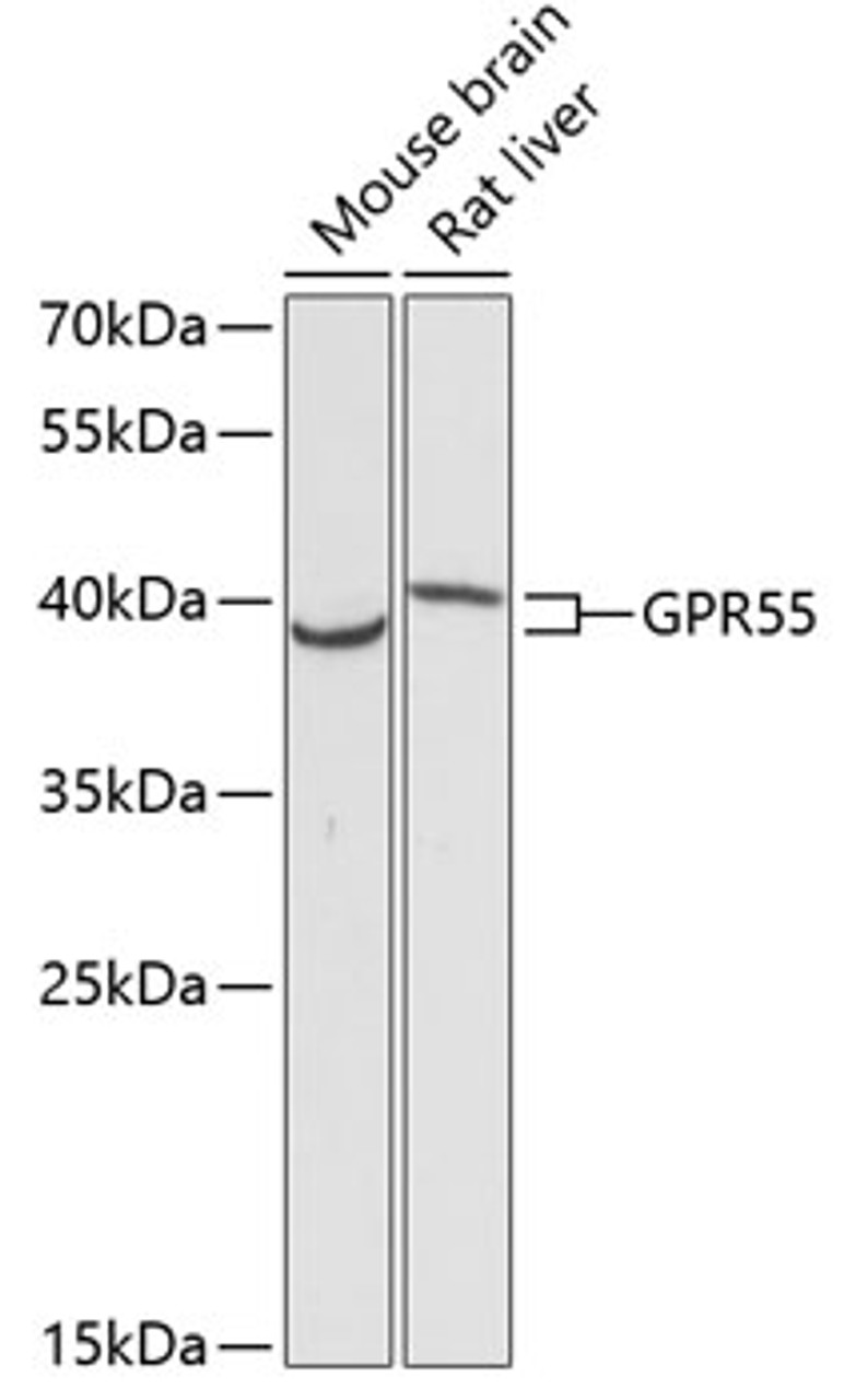 Western blot analysis of extracts of various cell lines, using GPR55 antibody (14-686) at 1:3000 dilution.<br/>Secondary antibody: HRP Goat Anti-Rabbit IgG (H+L) at 1:10000 dilution.<br/>Lysates/proteins: 25ug per lane.<br/>Blocking buffer: 3% nonfat dry milk in TBST.<br/>Detection: ECL Basic Kit.<br/>Exposure time: 90s.