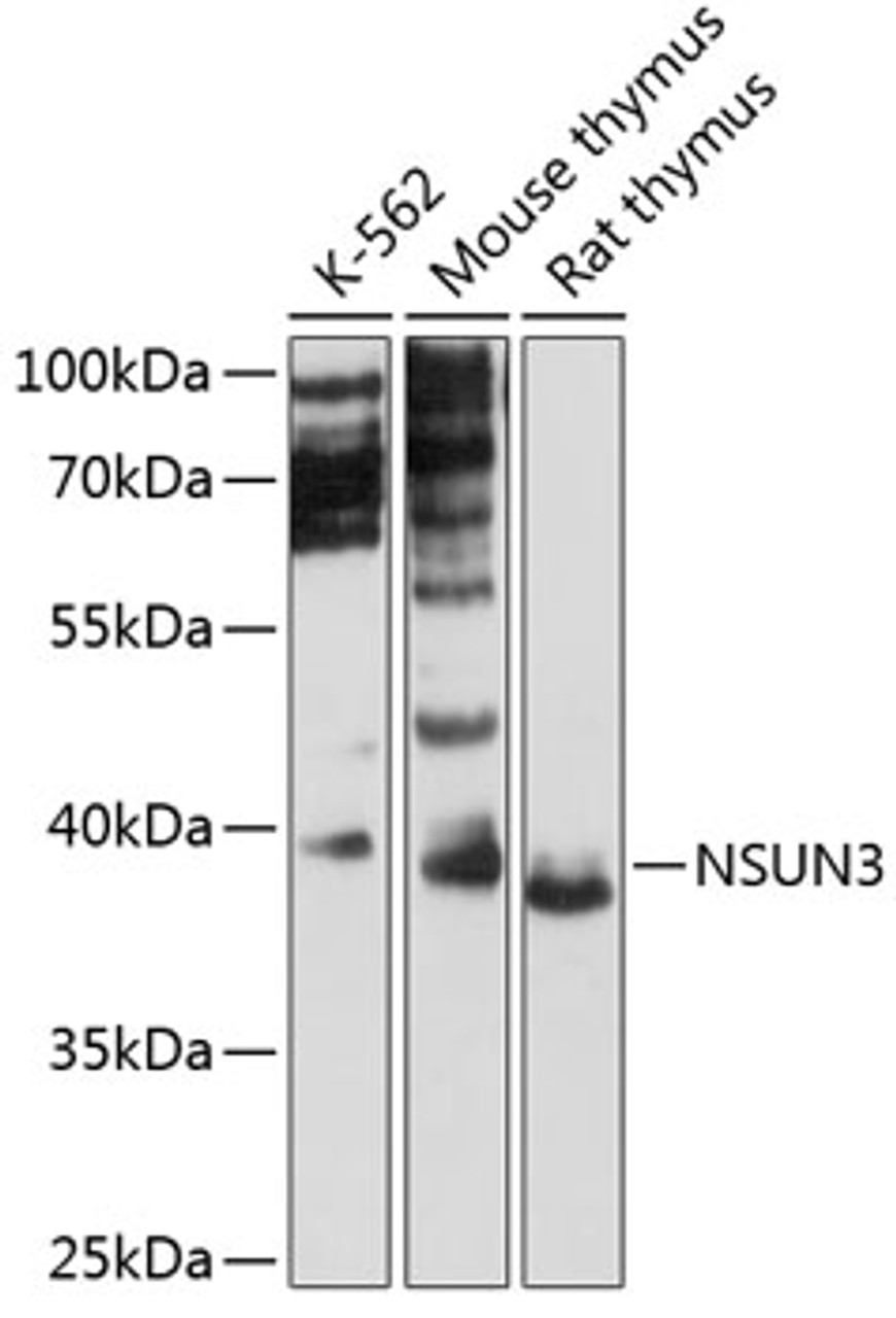 Western blot analysis of extracts of various cell lines, using NSUN3 antibody (14-687) at 1:3000 dilution.<br/>Secondary antibody: HRP Goat Anti-Rabbit IgG (H+L) at 1:10000 dilution.<br/>Lysates/proteins: 25ug per lane.<br/>Blocking buffer: 3% nonfat dry milk in TBST.<br/>Detection: ECL Basic Kit.<br/>Exposure time: 30s.