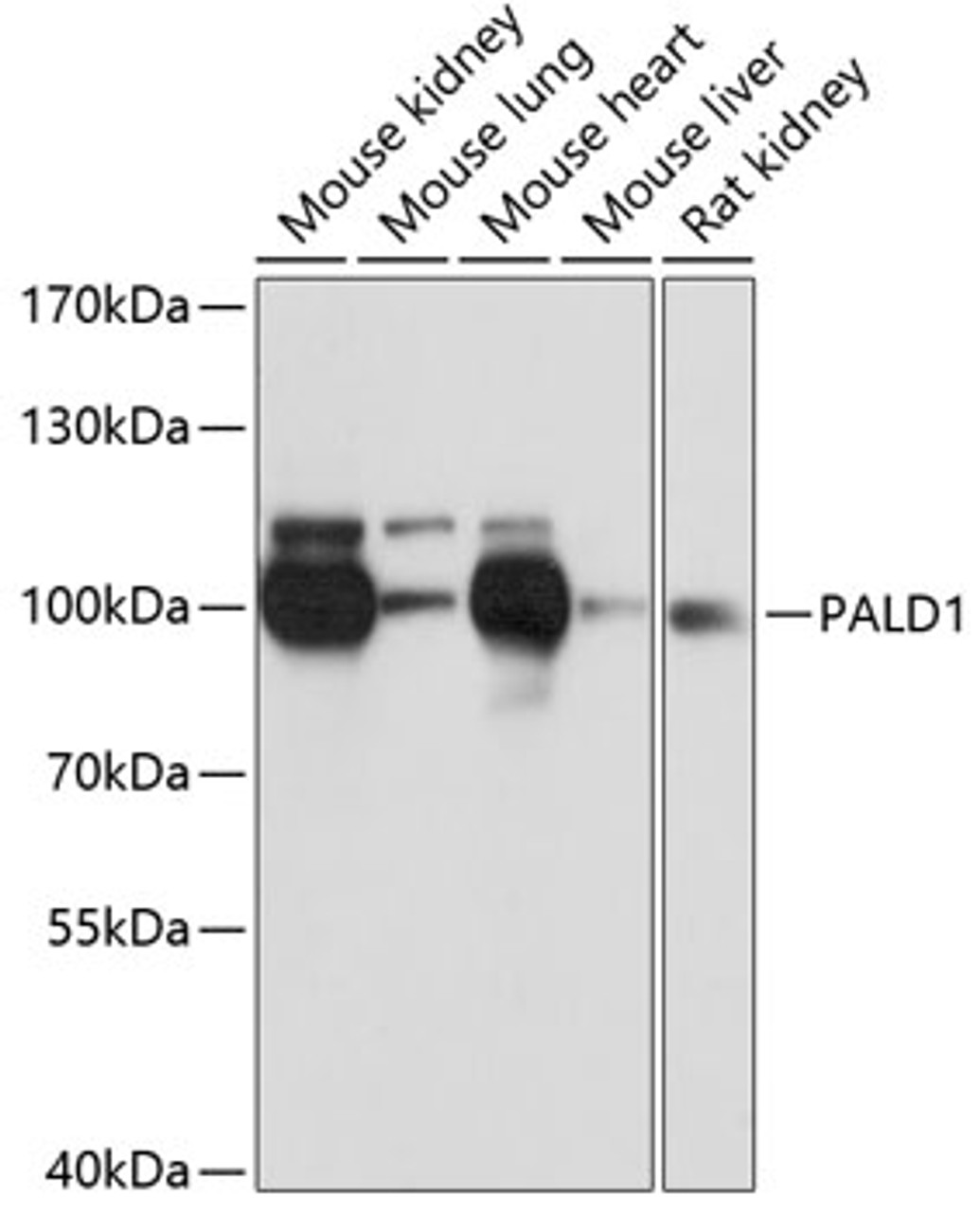 Western blot analysis of extracts of various cell lines, using PALD1 antibody (14-688) at 1:3000 dilution.<br/>Secondary antibody: HRP Goat Anti-Rabbit IgG (H+L) at 1:10000 dilution.<br/>Lysates/proteins: 25ug per lane.<br/>Blocking buffer: 3% nonfat dry milk in TBST.<br/>Detection: ECL Basic Kit.<br/>Exposure time: 1s.