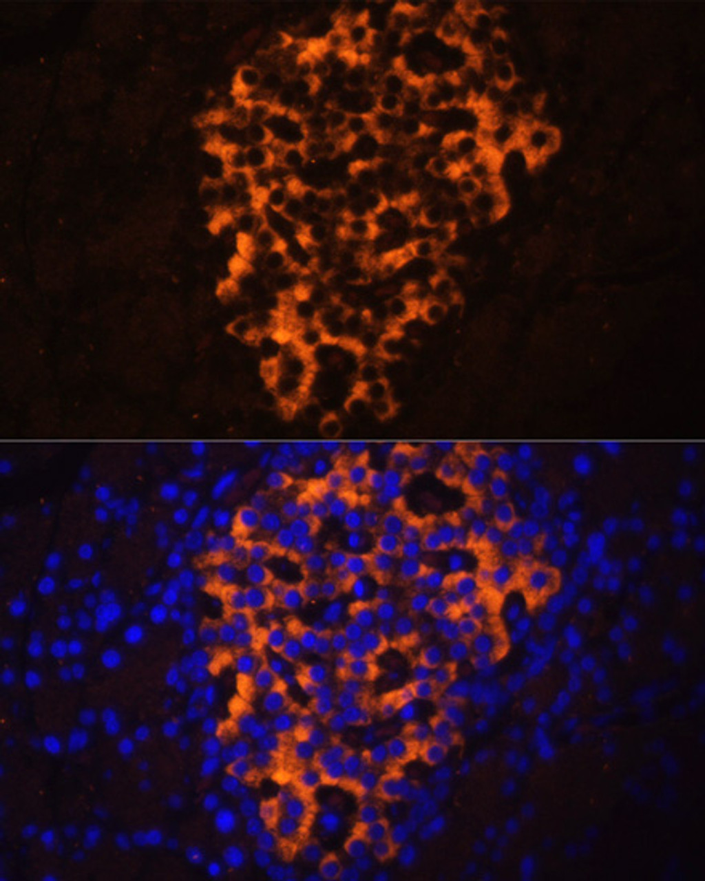 Immunofluorescence analysis of rat pancreas using PNLIPRP2 antibody (14-689) at dilution of 1:100. Blue: DAPI for nuclear staining.