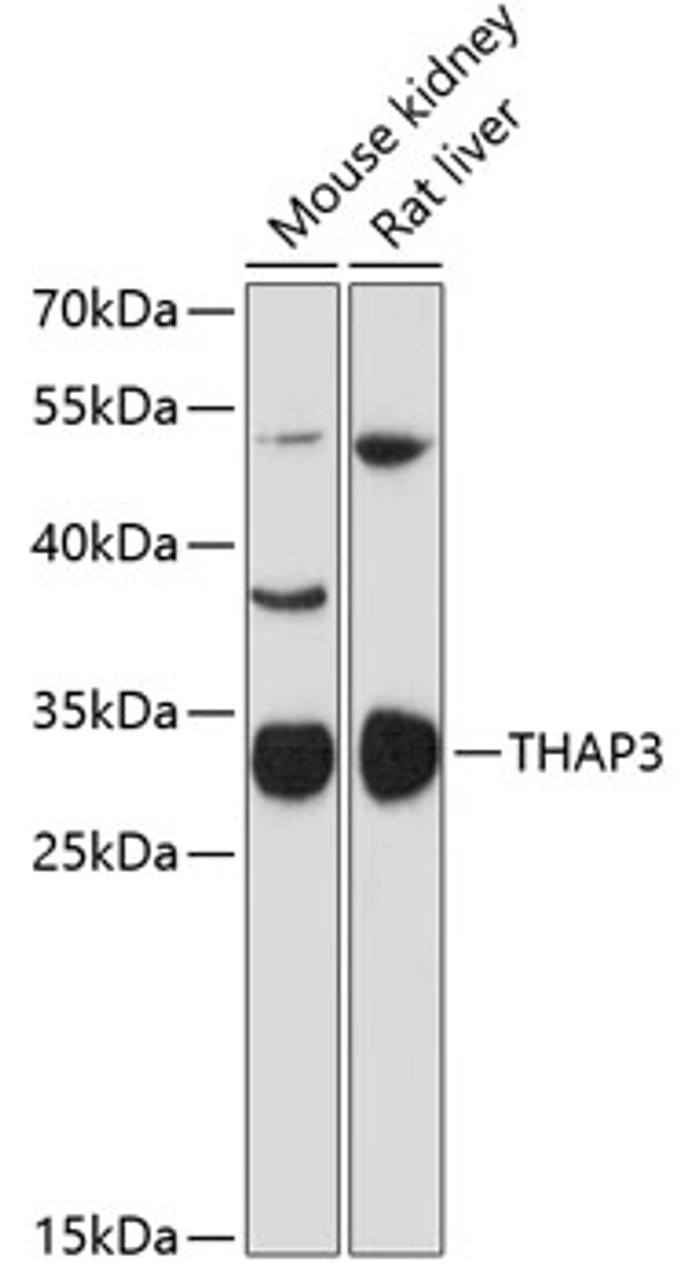 Western blot analysis of extracts of various cell lines, using THAP3 antibody (14-691) at 1:3000 dilution.<br/>Secondary antibody: HRP Goat Anti-Rabbit IgG (H+L) at 1:10000 dilution.<br/>Lysates/proteins: 25ug per lane.<br/>Blocking buffer: 3% nonfat dry milk in TBST.<br/>Detection: ECL Basic Kit.<br/>Exposure time: 90s.