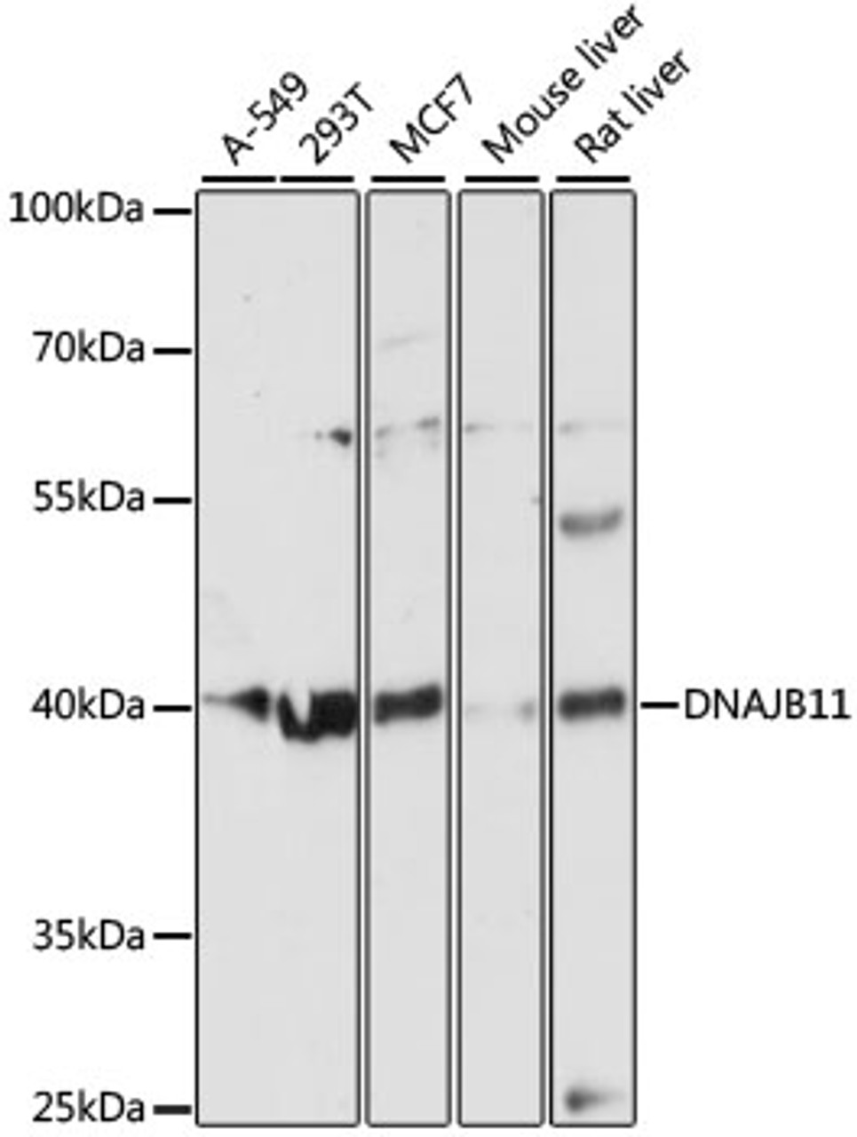 Western blot analysis of extracts of various cell lines, using DNAJB11 antibody (14-698) at 1:3000 dilution.<br/>Secondary antibody: HRP Goat Anti-Rabbit IgG (H+L) at 1:10000 dilution.<br/>Lysates/proteins: 25ug per lane.<br/>Blocking buffer: 3% nonfat dry milk in TBST.<br/>Detection: ECL Basic Kit.<br/>Exposure time: 90s.