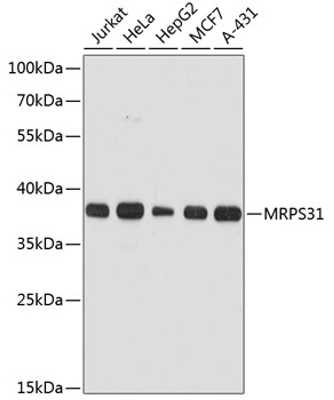 Western blot analysis of extracts of various cell lines, using MRPS31 antibody (14-700) at 1:3000 dilution.<br/>Secondary antibody: HRP Goat Anti-Rabbit IgG (H+L) at 1:10000 dilution.<br/>Lysates/proteins: 25ug per lane.<br/>Blocking buffer: 3% nonfat dry milk in TBST.<br/>Detection: ECL Basic Kit.<br/>Exposure time: 30s.