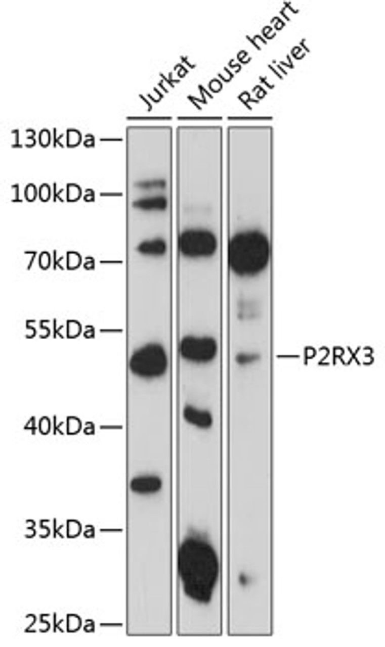 Western blot analysis of extracts of various cell lines, using P2RX3 antibody (14-701) at 1:3000 dilution.<br/>Secondary antibody: HRP Goat Anti-Rabbit IgG (H+L) at 1:10000 dilution.<br/>Lysates/proteins: 25ug per lane.<br/>Blocking buffer: 3% nonfat dry milk in TBST.<br/>Detection: ECL Enhanced Kit.<br/>Exposure time: 90s.