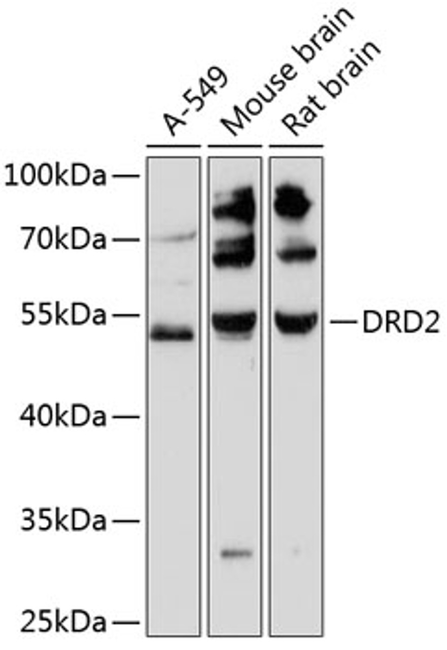 Western blot analysis of extracts of various cell lines, using DRD2 antibody (14-705) at 1:3000 dilution.<br/>Secondary antibody: HRP Goat Anti-Rabbit IgG (H+L) at 1:10000 dilution.<br/>Lysates/proteins: 25ug per lane.<br/>Blocking buffer: 3% nonfat dry milk in TBST.<br/>Detection: ECL Basic Kit.<br/>Exposure time: 90s.