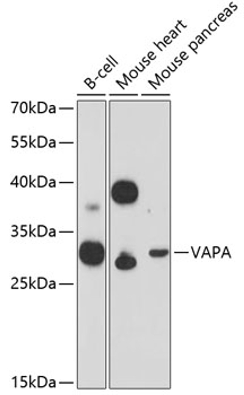 Western blot analysis of extracts of various cell lines, using VAPA Antibody (14-709) at 1:3000 dilution.<br/>Secondary antibody: HRP Goat Anti-Rabbit IgG (H+L) at 1:10000 dilution.<br/>Lysates/proteins: 25ug per lane.<br/>Blocking buffer: 3% nonfat dry milk in TBST.<br/>Detection: ECL Enhanced Kit.<br/>Exposure time: 90s.