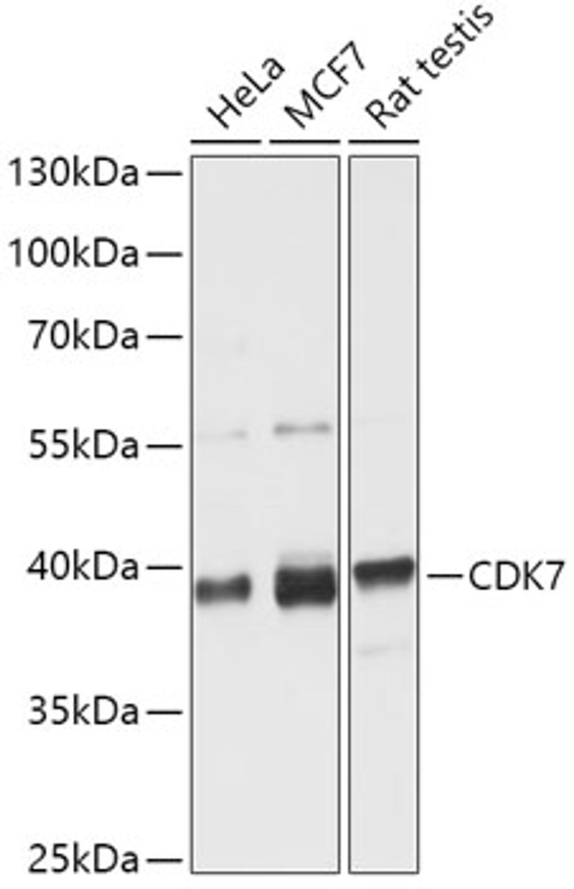 Western blot analysis of extracts of various cell lines, using CDK7 antibody (14-712) at 1:1000 dilution.<br/>Secondary antibody: HRP Goat Anti-Rabbit IgG (H+L) at 1:10000 dilution.<br/>Lysates/proteins: 25ug per lane.<br/>Blocking buffer: 3% nonfat dry milk in TBST.<br/>Detection: ECL Basic Kit.<br/>Exposure time: 15s.