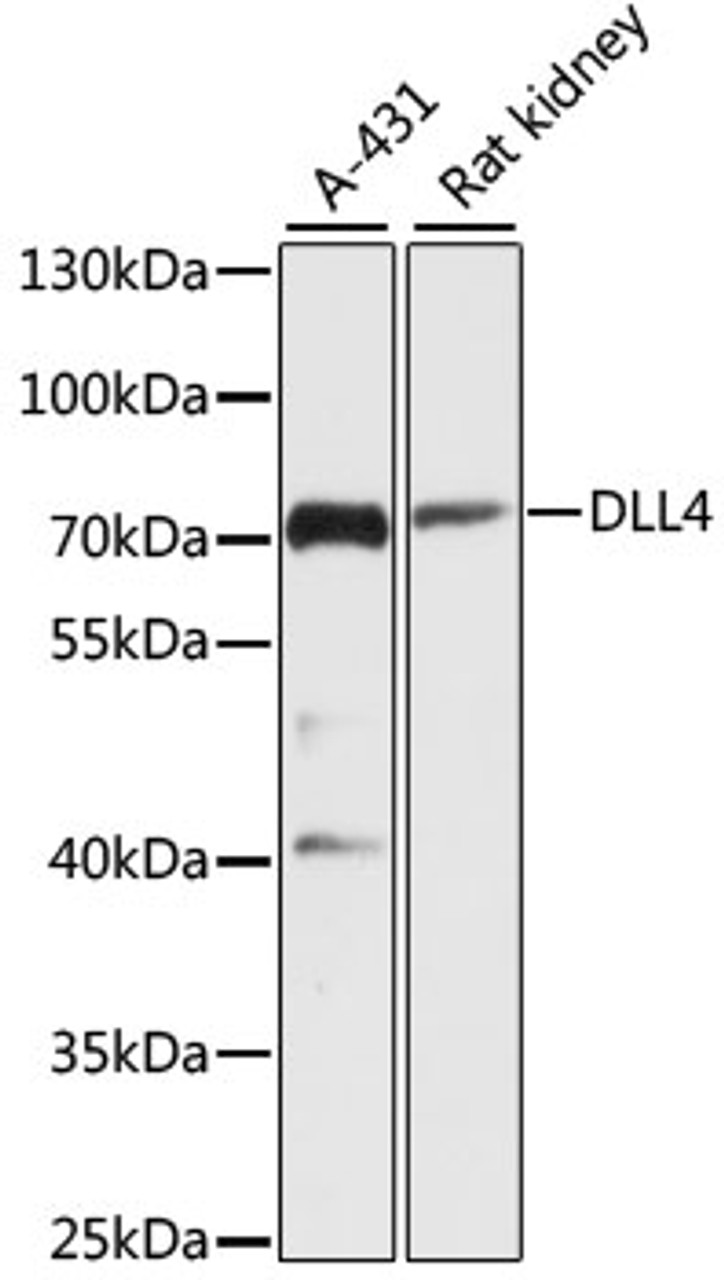 Western blot analysis of extracts of various cell lines, using DLL4 antibody (14-713) at 1:3000 dilution.<br/>Secondary antibody: HRP Goat Anti-Rabbit IgG (H+L) at 1:10000 dilution.<br/>Lysates/proteins: 25ug per lane.<br/>Blocking buffer: 3% nonfat dry milk in TBST.<br/>Detection: ECL Basic Kit.<br/>Exposure time: 90s.