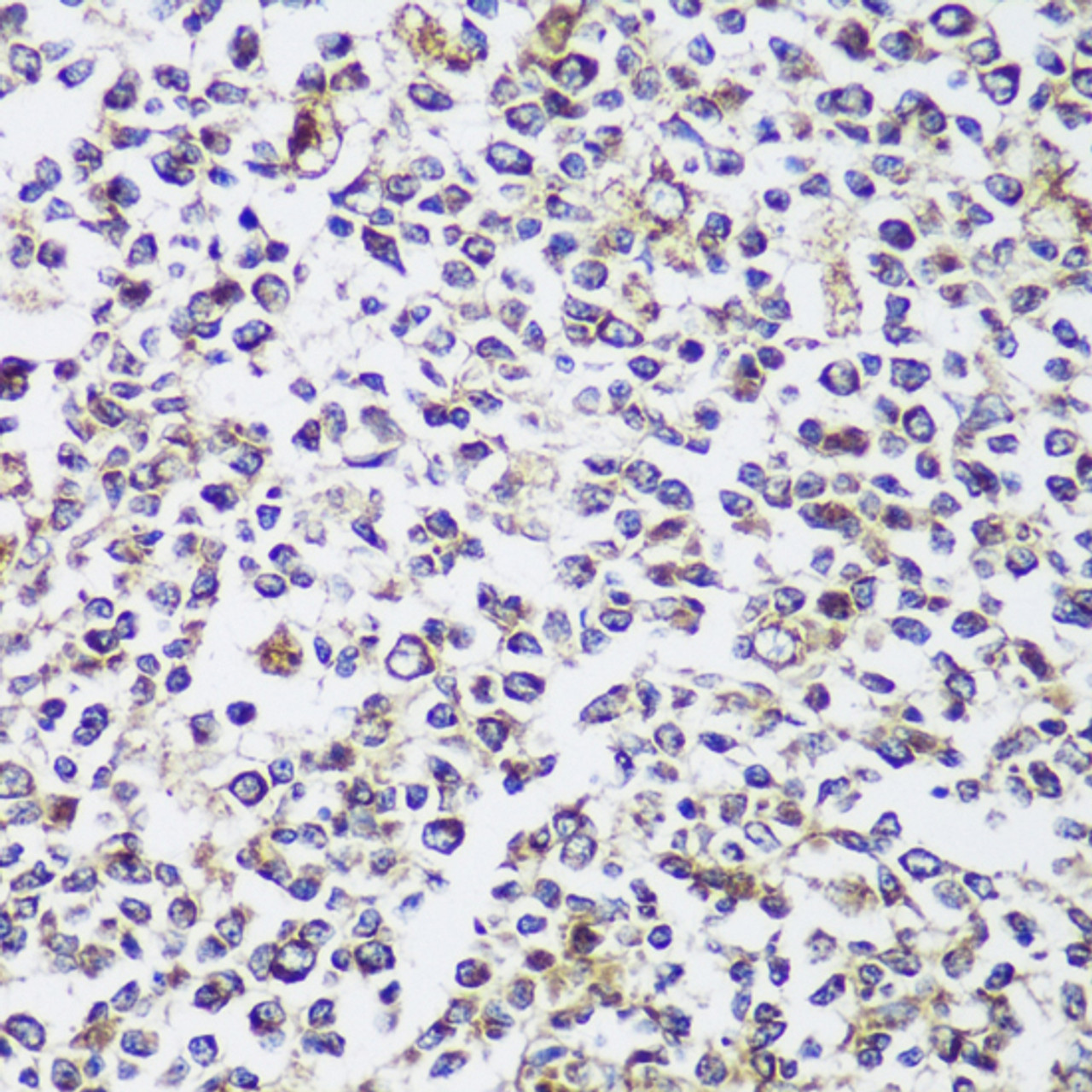 Immunohistochemistry of paraffin-embedded human tonsil using ECH1 antibody (14-714) at dilution of 1:150 (40x lens) .