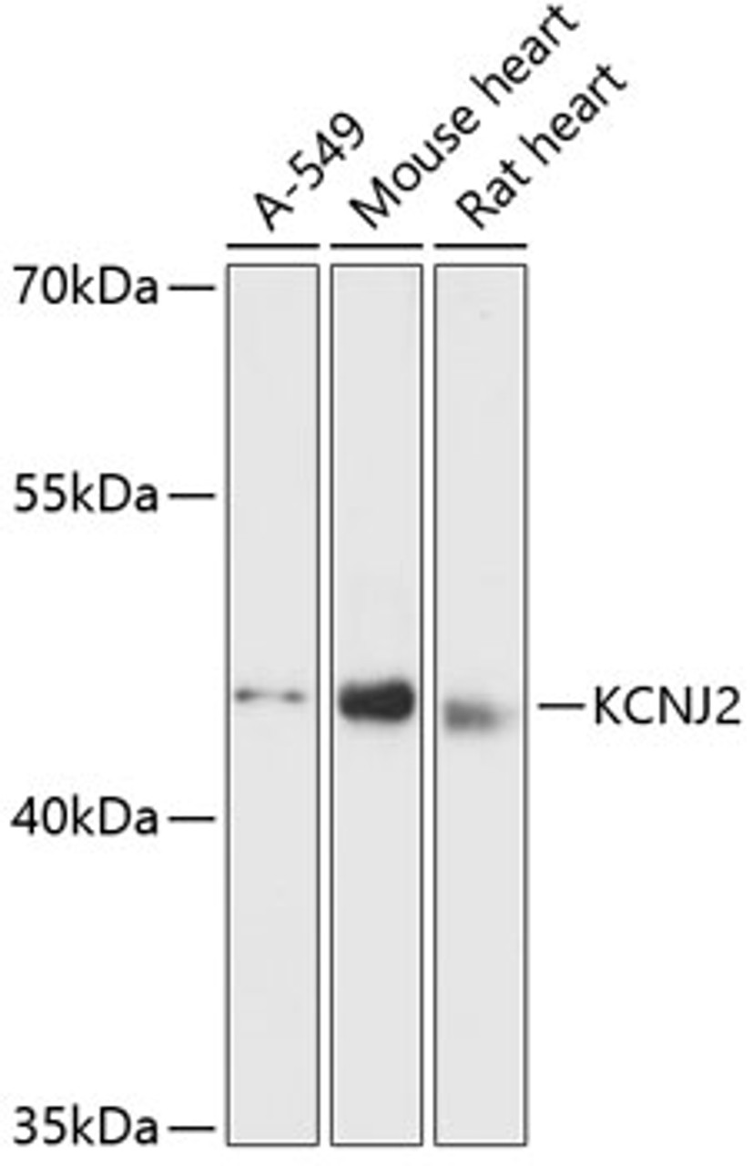 Western blot analysis of extracts of various cell lines, using KCNJ2 antibody (14-718) at 1:3000 dilution.<br/>Secondary antibody: HRP Goat Anti-Rabbit IgG (H+L) at 1:10000 dilution.<br/>Lysates/proteins: 25ug per lane.<br/>Blocking buffer: 3% nonfat dry milk in TBST.<br/>Detection: ECL Basic Kit.<br/>Exposure time: 90s.