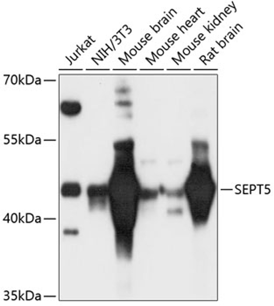 Western blot analysis of extracts of various cell lines, using SEPT5 antibody (14-722) at 1:3000 dilution.<br/>Secondary antibody: HRP Goat Anti-Rabbit IgG (H+L) at 1:10000 dilution.<br/>Lysates/proteins: 25ug per lane.<br/>Blocking buffer: 3% nonfat dry milk in TBST.<br/>Detection: ECL Basic Kit.<br/>Exposure time: 30s.