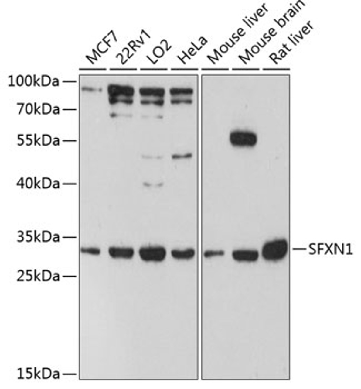 Western blot analysis of extracts of various cell lines, using SFXN1 antibody (14-723) at 1:3000 dilution.<br/>Secondary antibody: HRP Goat Anti-Rabbit IgG (H+L) at 1:10000 dilution.<br/>Lysates/proteins: 25ug per lane.<br/>Blocking buffer: 3% nonfat dry milk in TBST.<br/>Detection: ECL Basic Kit.<br/>Exposure time: 90s.